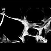 Por&ouml;ser Knochen 